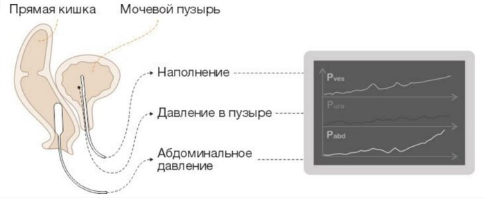 Схема проведения уродинамических исследованийи